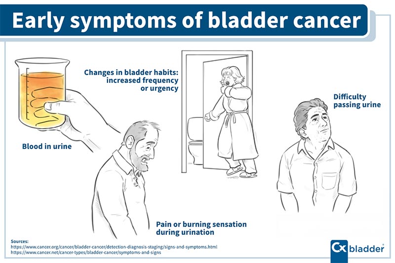 What Are the First Signs & Symptoms of Bladder Cancer? | Cxbladder