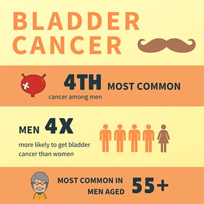 Bladder Cancer, Men's Health & Movember | Cxbladder