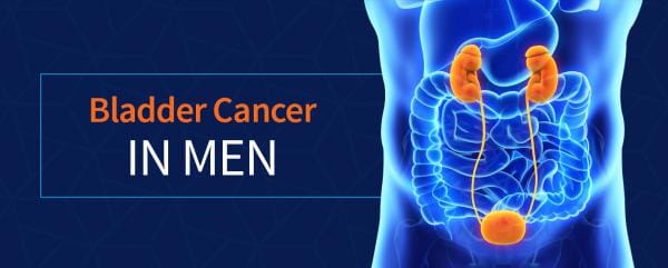 Bladder Cancer In Men Cxbladder