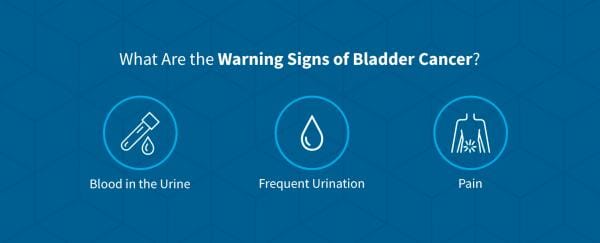 What Causes Bladder Cancer - Risks and Signs | Cxbladder