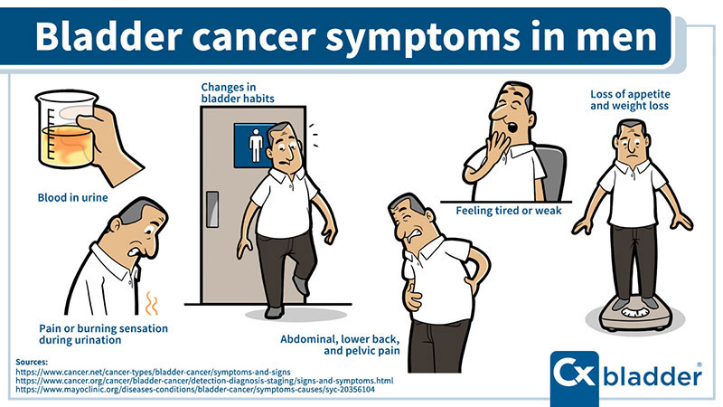 Male Bladder Cancer Symptoms: Early Warning Signs